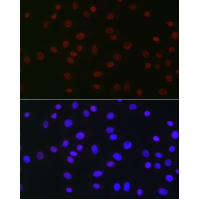 Immunofluorescence - Anti-USP39 Antibody [ARC2588] (A306442) - Antibodies.com