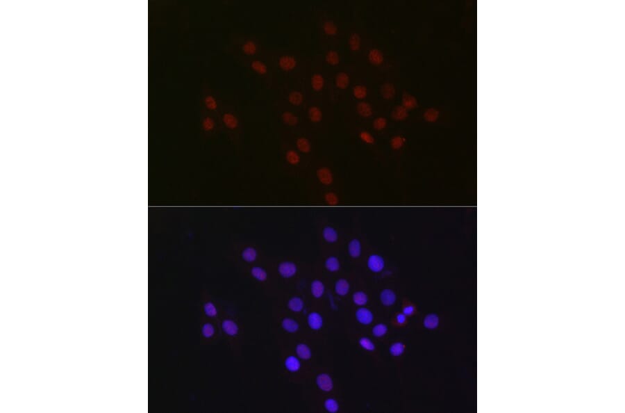 Immunofluorescence - Anti-USP39 Antibody [ARC2588] (A306442) - Antibodies.com