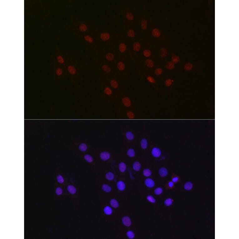 Immunofluorescence - Anti-USP39 Antibody [ARC2588] (A306442) - Antibodies.com