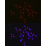 Immunofluorescence - Anti-USP39 Antibody [ARC2588] (A306442) - Antibodies.com