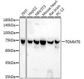 Western Blot - Anti-TOM70 Antibody [ARC53258] (A306443) - Antibodies.com