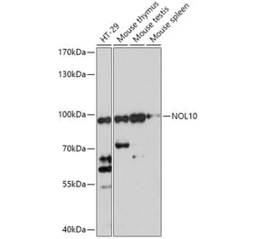 Western Blot - Anti-NOL10 Antibody (A306445) - Antibodies.com