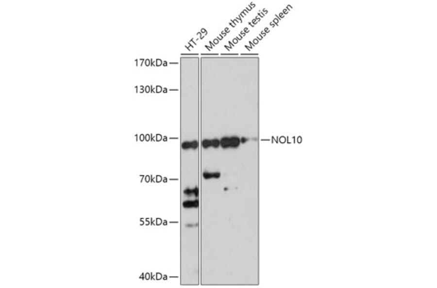 Western Blot - Anti-NOL10 Antibody (A306445) - Antibodies.com
