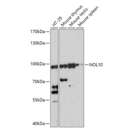 Western Blot - Anti-NOL10 Antibody (A306445) - Antibodies.com