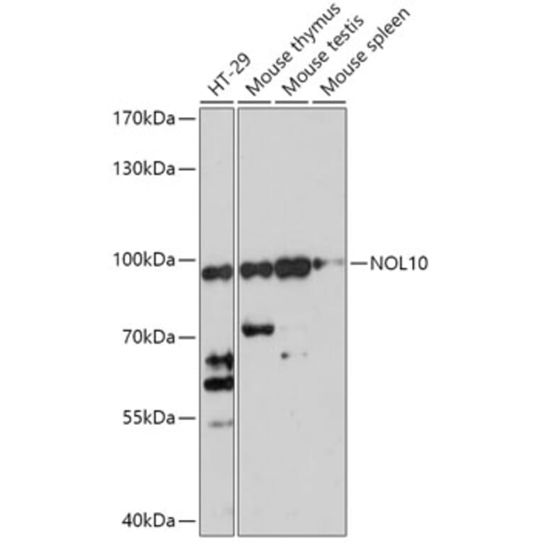 Western Blot - Anti-NOL10 Antibody (A306445) - Antibodies.com