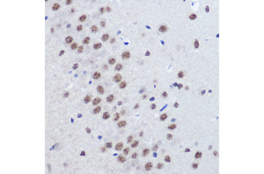 Immunohistochemistry - Anti-JMJD1C Antibody (A306447) - Antibodies.com