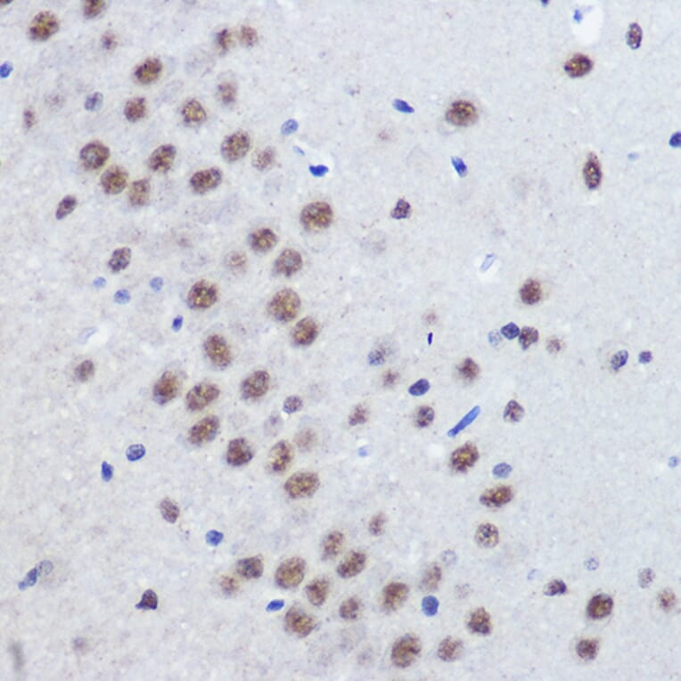 Immunohistochemistry - Anti-JMJD1C Antibody (A306447) - Antibodies.com