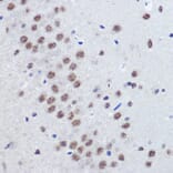 Immunohistochemistry - Anti-JMJD1C Antibody (A306447) - Antibodies.com