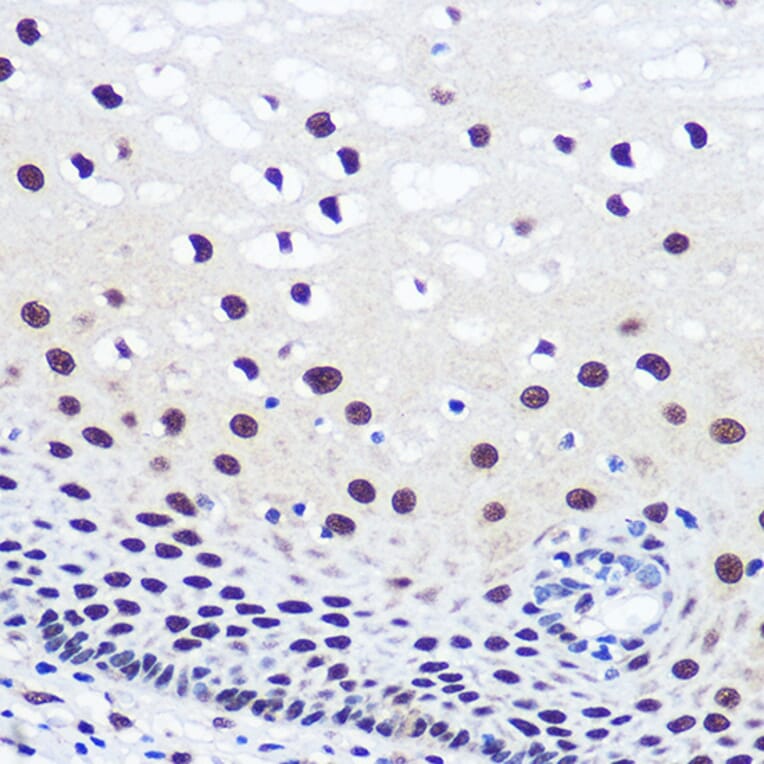 Immunohistochemistry - Anti-JMJD1C Antibody (A306447) - Antibodies.com