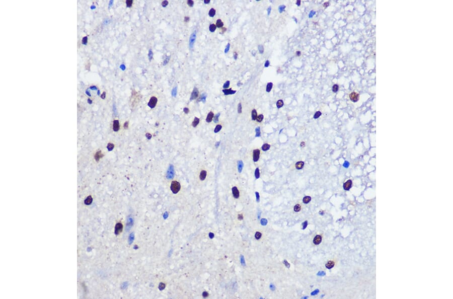 Immunohistochemistry - Anti-JMJD1C Antibody (A306447) - Antibodies.com