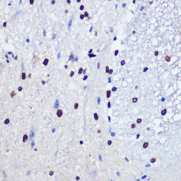 Immunohistochemistry - Anti-JMJD1C Antibody (A306447) - Antibodies.com