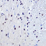 Immunohistochemistry - Anti-JMJD1C Antibody (A306447) - Antibodies.com