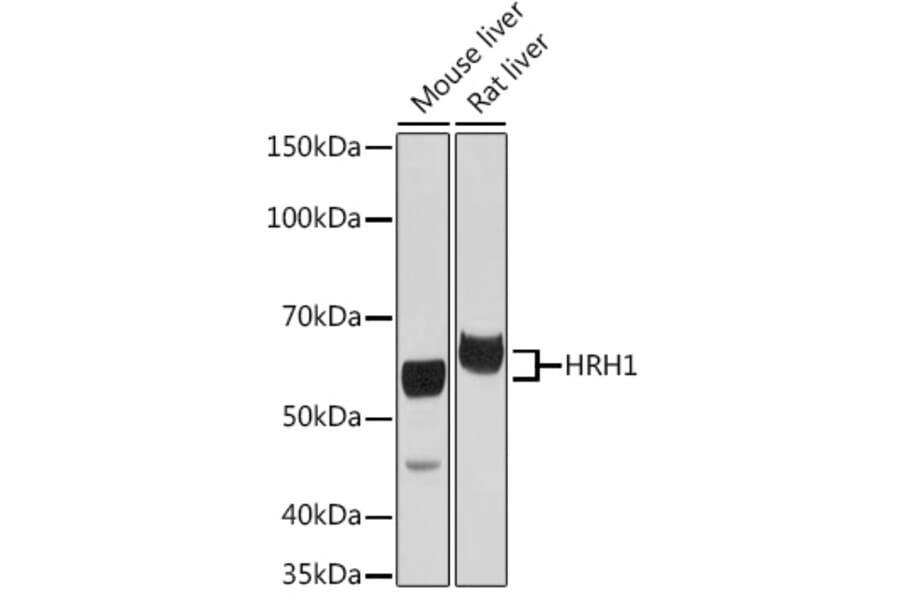 Western Blot - Anti-HRH1/H1R Antibody (A306448) - Antibodies.com