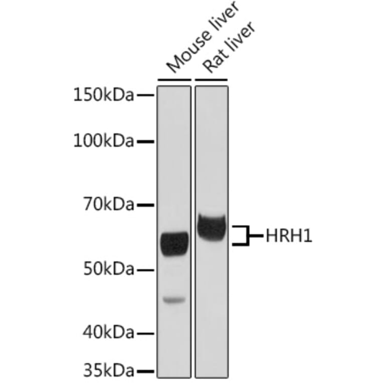 Western Blot - Anti-HRH1/H1R Antibody (A306448) - Antibodies.com