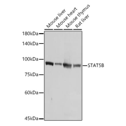 Western Blot - Anti-STAT5 Antibody (A306449) - Antibodies.com
