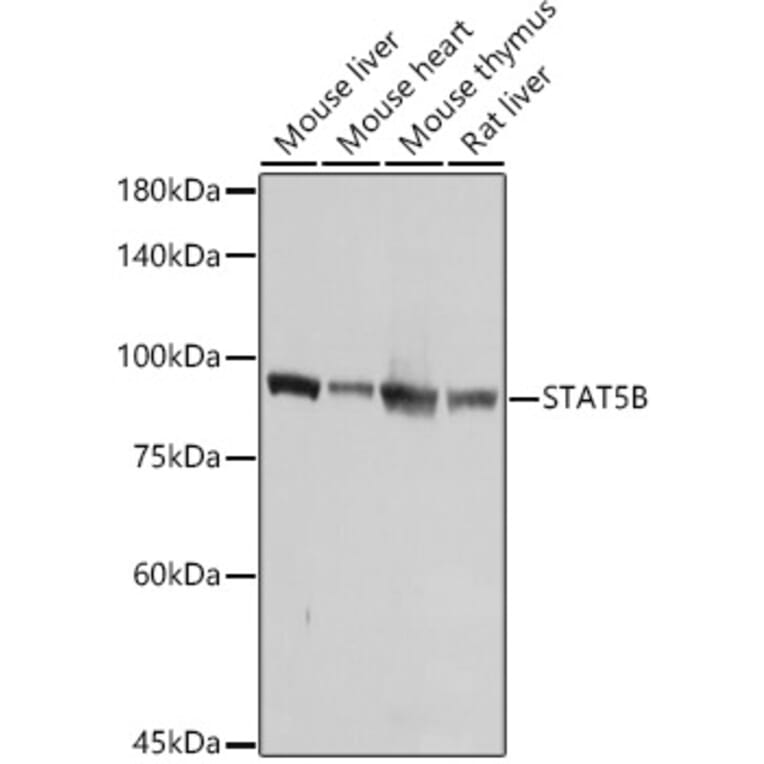 Western Blot - Anti-STAT5 Antibody (A306449) - Antibodies.com