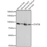 Western Blot - Anti-STAT5 Antibody (A306449) - Antibodies.com