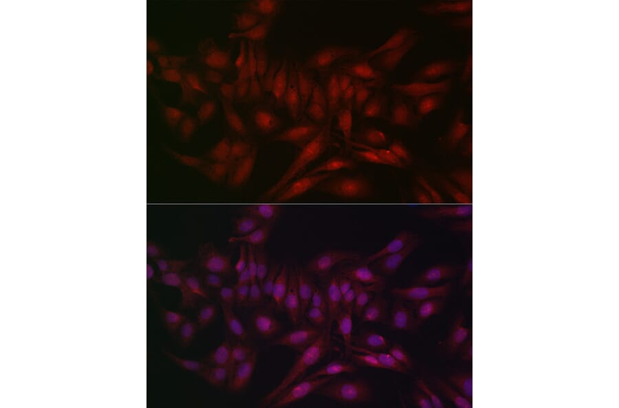 Immunofluorescence - Anti-STAT5 Antibody (A306449) - Antibodies.com
