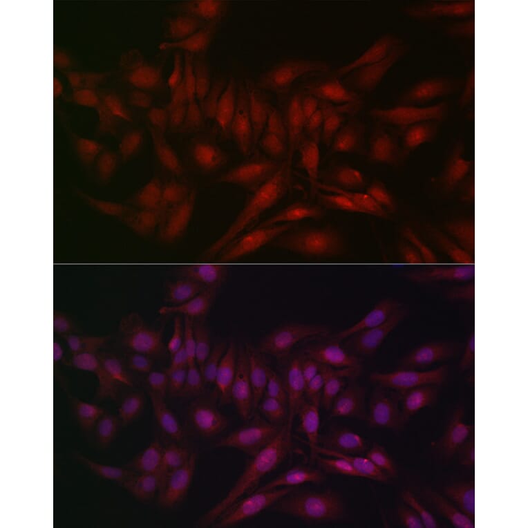 Immunofluorescence - Anti-STAT5 Antibody (A306449) - Antibodies.com