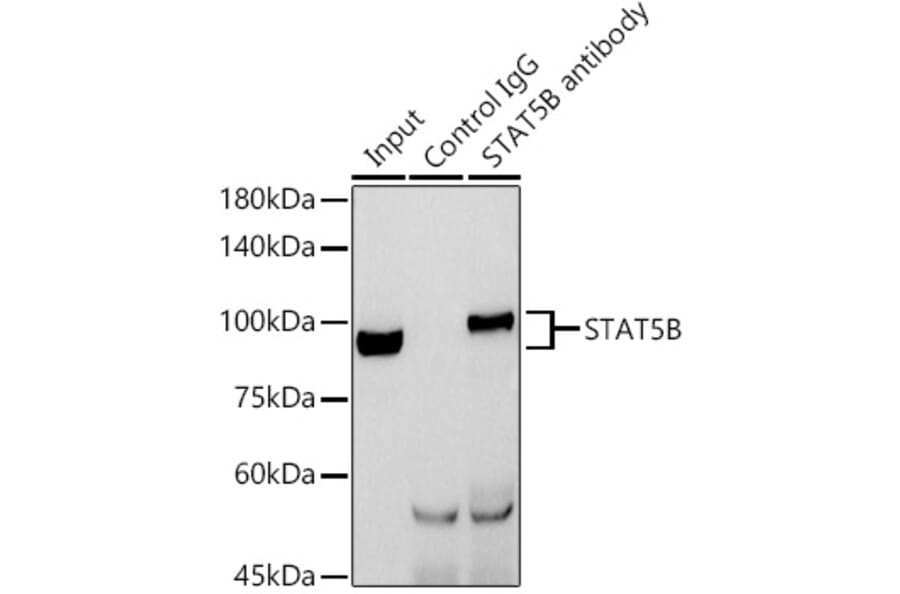 Western Blot - Anti-STAT5 Antibody (A306449) - Antibodies.com