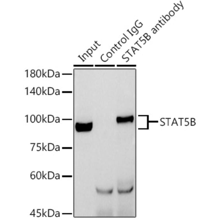 Western Blot - Anti-STAT5 Antibody (A306449) - Antibodies.com