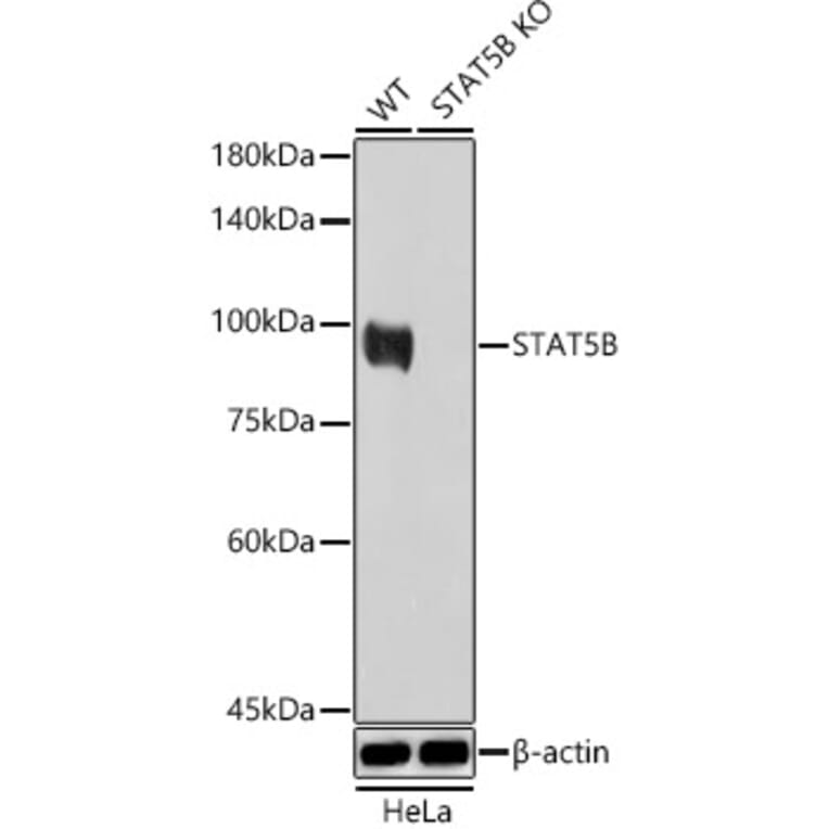 Western Blot - Anti-STAT5 Antibody (A306449) - Antibodies.com