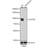 Western Blot - Anti-STAT5 Antibody (A306449) - Antibodies.com