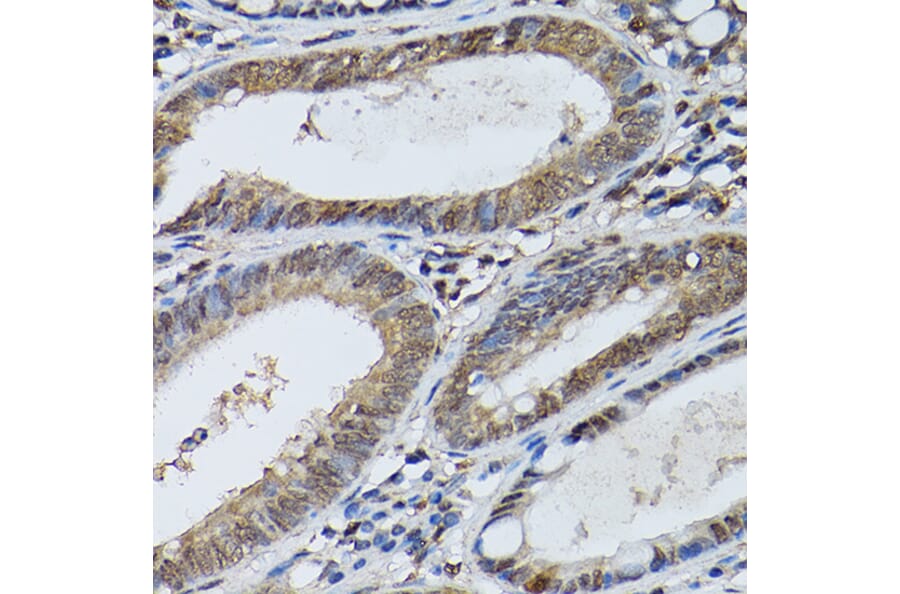Immunohistochemistry - Anti-STAT5 Antibody (A306449) - Antibodies.com