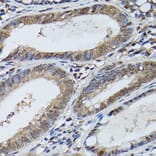 Immunohistochemistry - Anti-STAT5 Antibody (A306449) - Antibodies.com