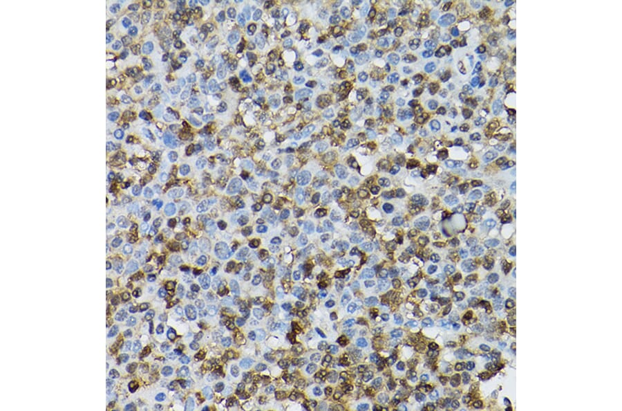 Immunohistochemistry - Anti-STAT5 Antibody (A306449) - Antibodies.com