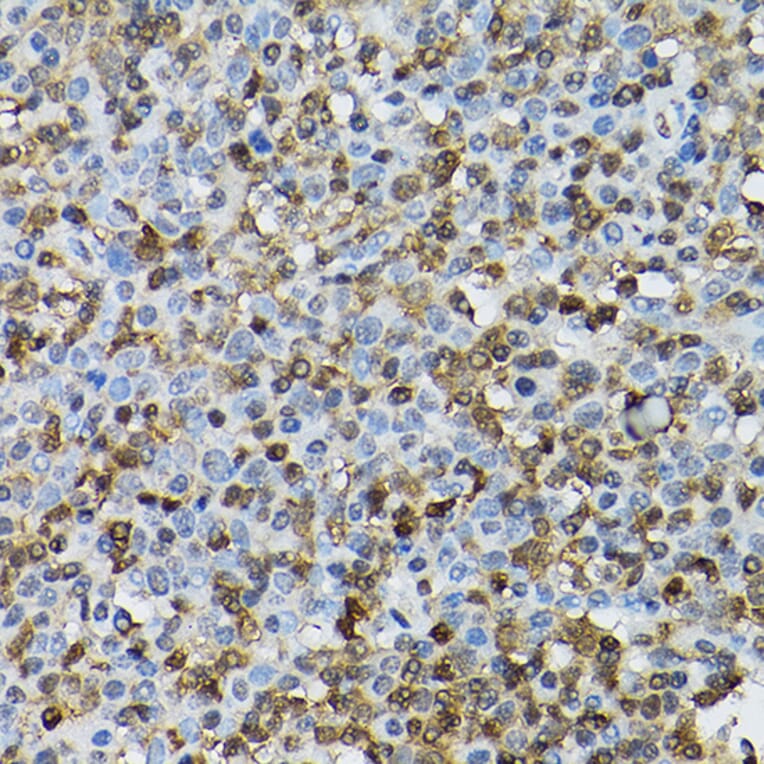 Immunohistochemistry - Anti-STAT5 Antibody (A306449) - Antibodies.com