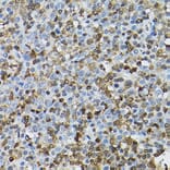 Immunohistochemistry - Anti-STAT5 Antibody (A306449) - Antibodies.com