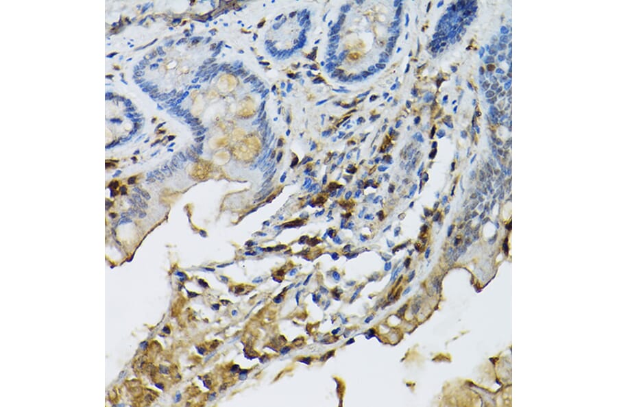 Immunohistochemistry - Anti-STAT5 Antibody (A306449) - Antibodies.com