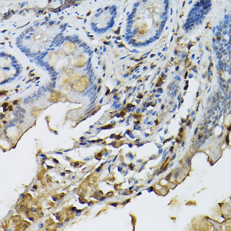 Immunohistochemistry - Anti-STAT5 Antibody (A306449) - Antibodies.com