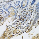 Immunohistochemistry - Anti-STAT5 Antibody (A306449) - Antibodies.com