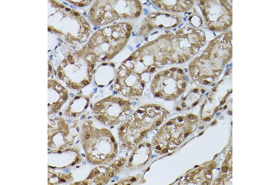 Immunohistochemistry - Anti-STAT5 Antibody (A306449) - Antibodies.com