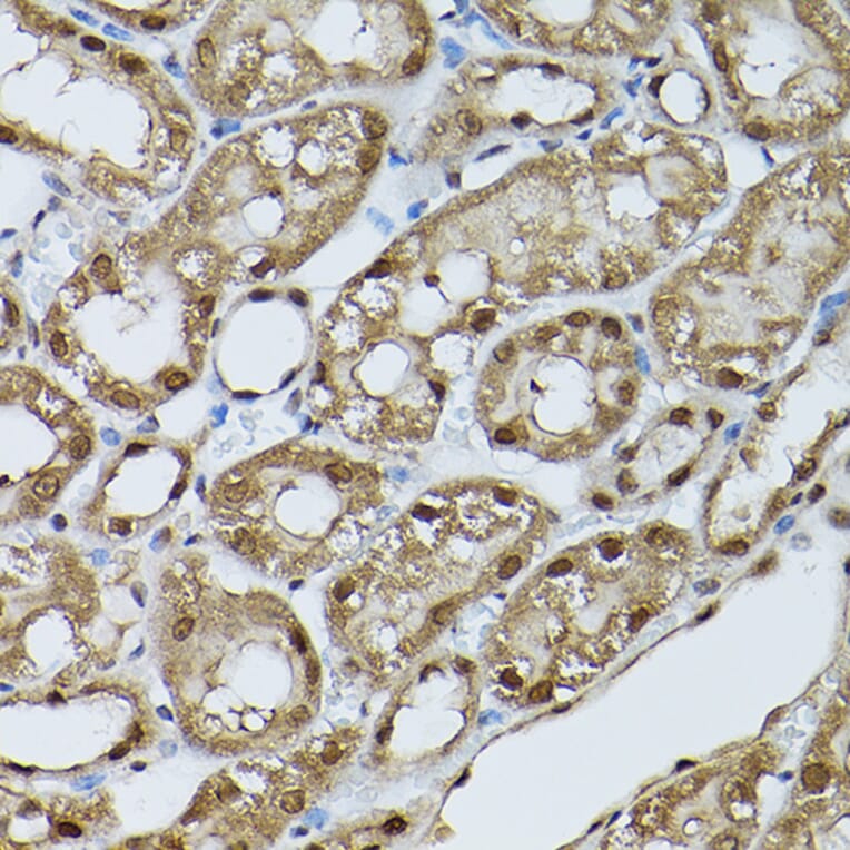 Immunohistochemistry - Anti-STAT5 Antibody (A306449) - Antibodies.com