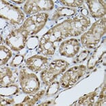 Immunohistochemistry - Anti-STAT5 Antibody (A306449) - Antibodies.com