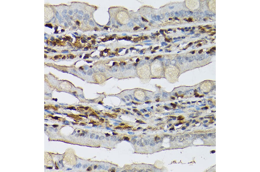 Immunohistochemistry - Anti-STAT5 Antibody (A306449) - Antibodies.com