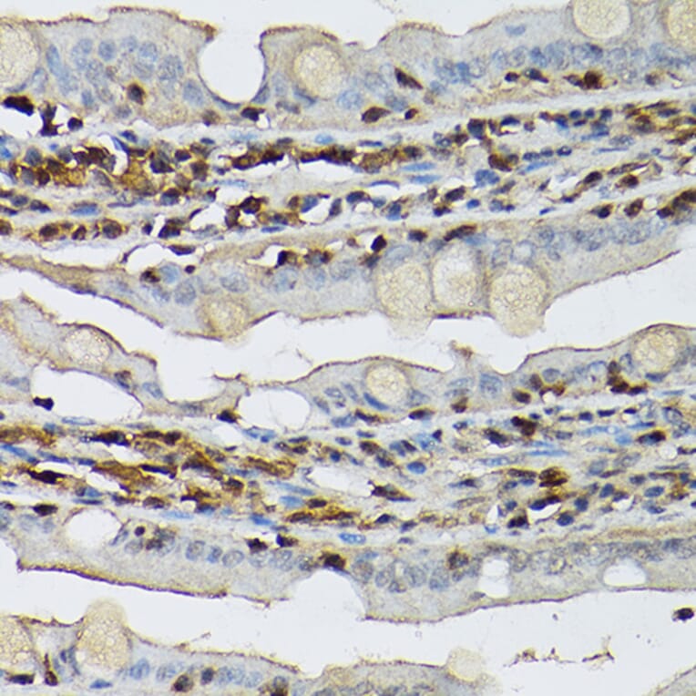 Immunohistochemistry - Anti-STAT5 Antibody (A306449) - Antibodies.com