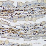 Immunohistochemistry - Anti-STAT5 Antibody (A306449) - Antibodies.com