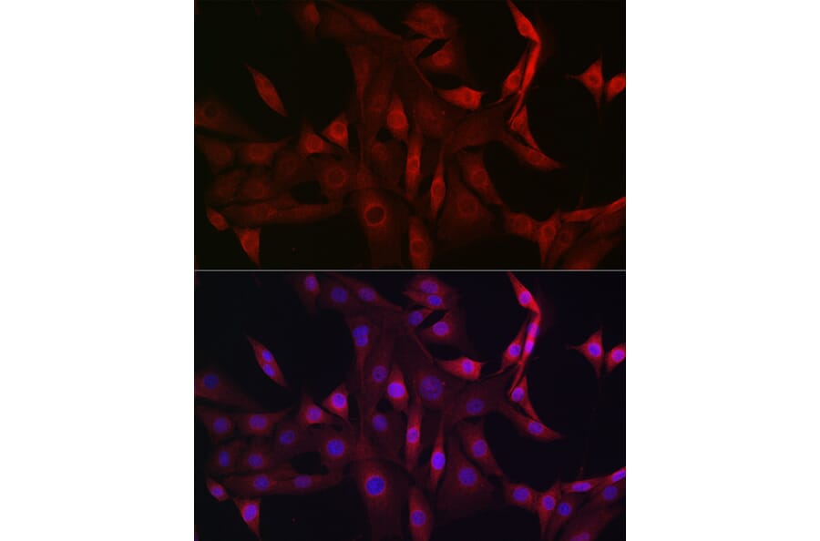 Immunofluorescence - Anti-STAT5 Antibody (A306449) - Antibodies.com