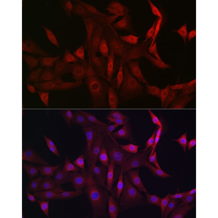 Immunofluorescence - Anti-STAT5 Antibody (A306449) - Antibodies.com