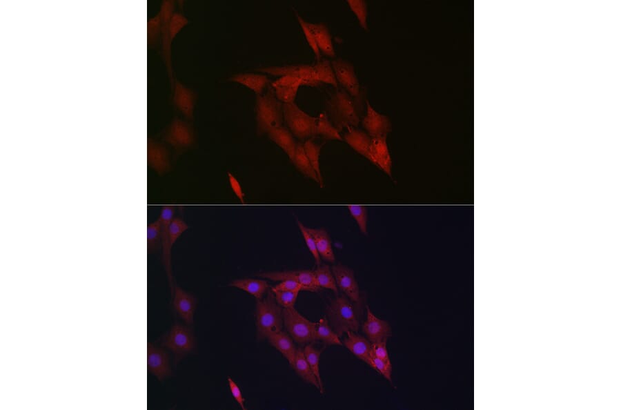 Immunofluorescence - Anti-STAT5 Antibody (A306449) - Antibodies.com