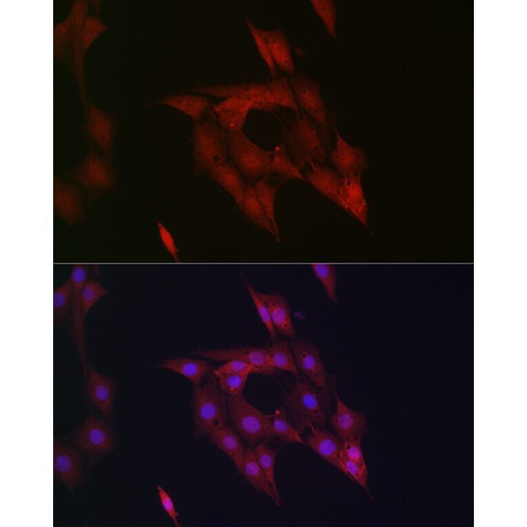 Immunofluorescence - Anti-STAT5 Antibody (A306449) - Antibodies.com