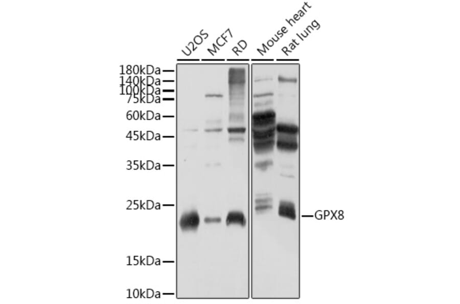 Western Blot - Anti-GPX8 Antibody (A306450) - Antibodies.com