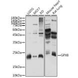 Western Blot - Anti-GPX8 Antibody (A306450) - Antibodies.com