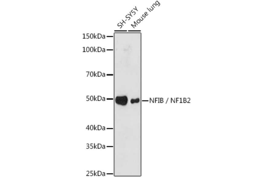 Western Blot - Anti-NFIB/NF1B2 Antibody [ARC1859] (A306451) - Antibodies.com