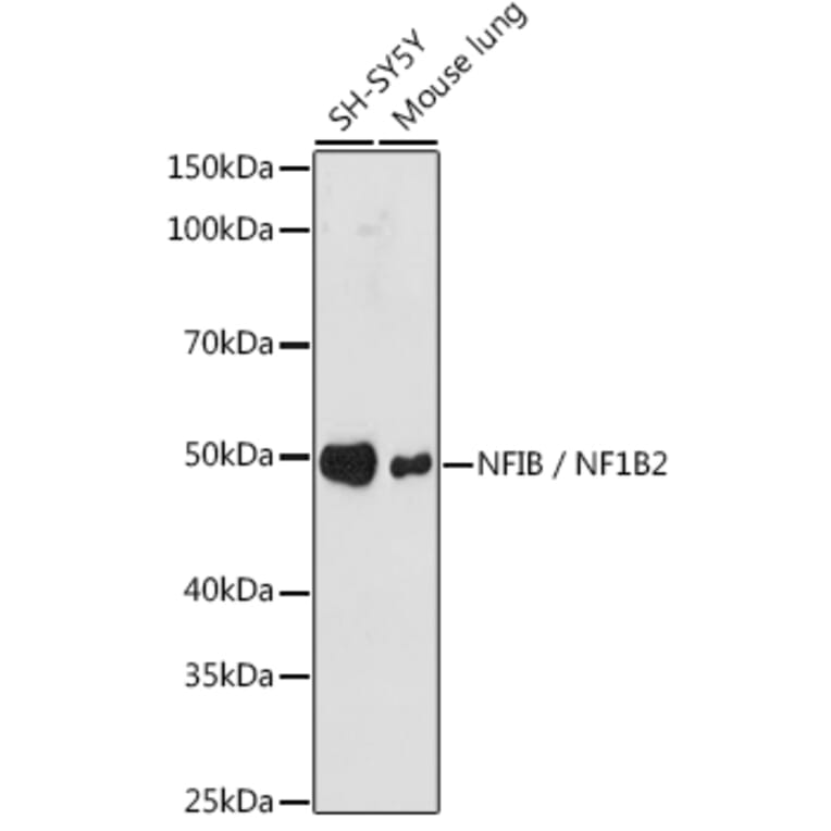 Western Blot - Anti-NFIB/NF1B2 Antibody [ARC1859] (A306451) - Antibodies.com