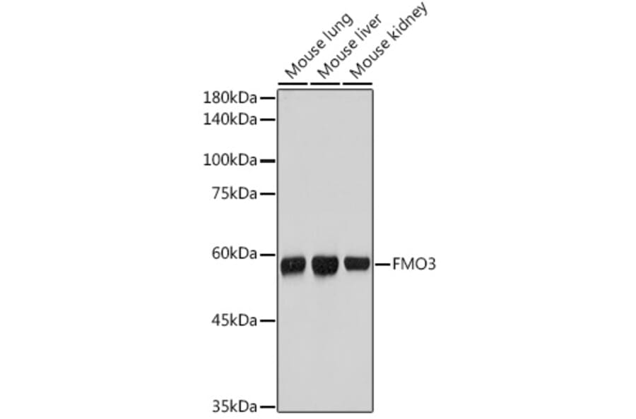 Western Blot - Anti-FMO3 Antibody [ARC2377] (A306452) - Antibodies.com
